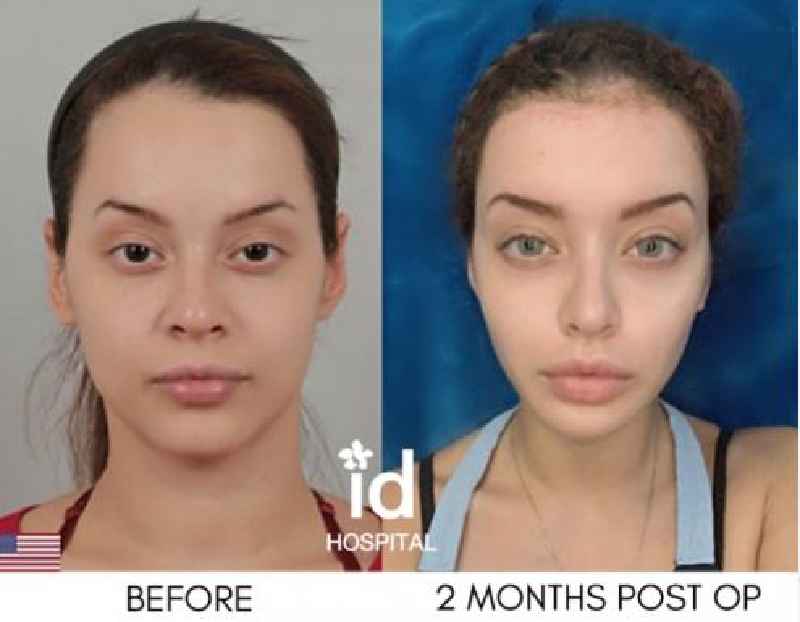 Why is plastic surgery so popular in Latin America