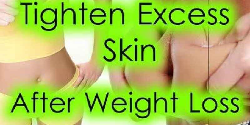 Will I have saggy skin after losing 50 pounds
